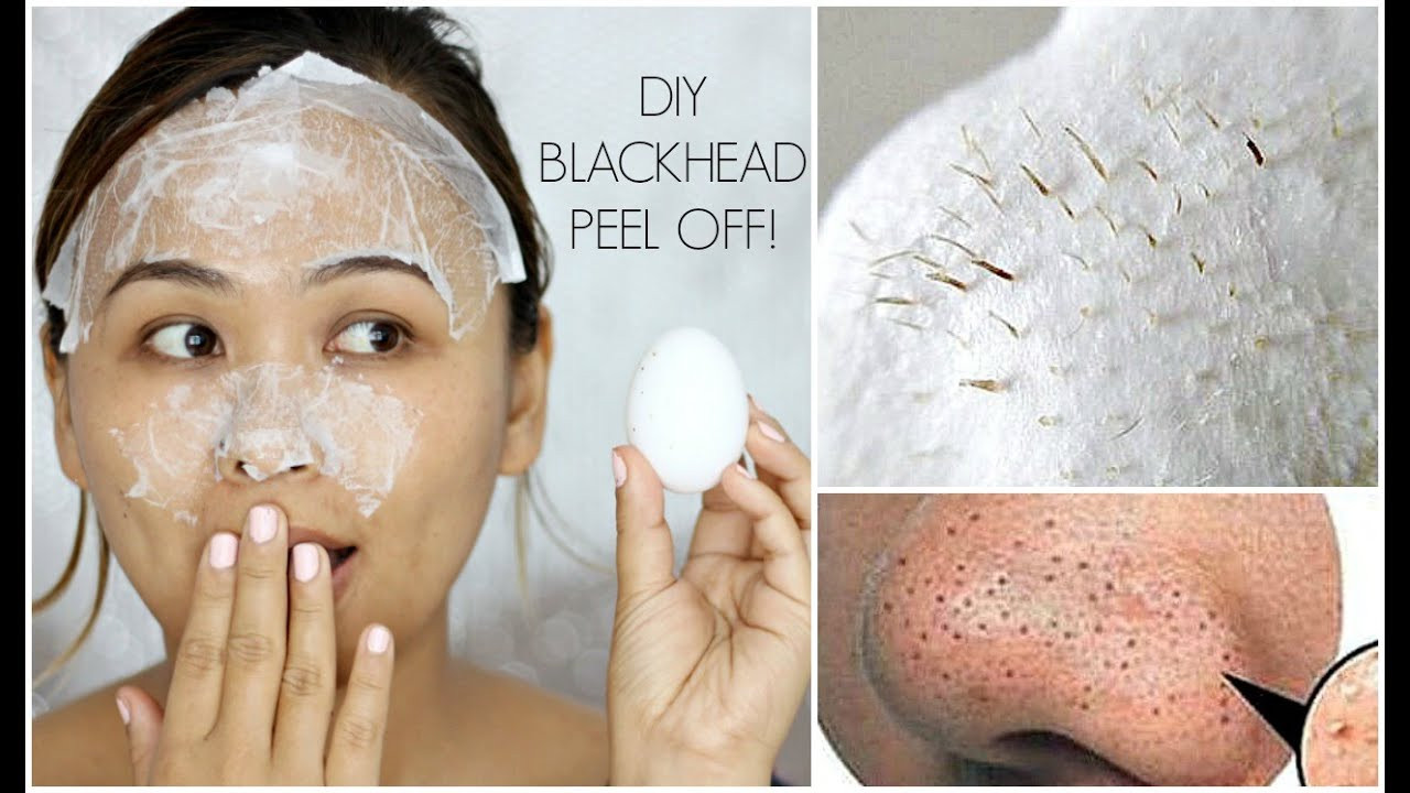 Anti Blackhead Maske Diy
 DIY Blackhead Peel f Mask with an Egg