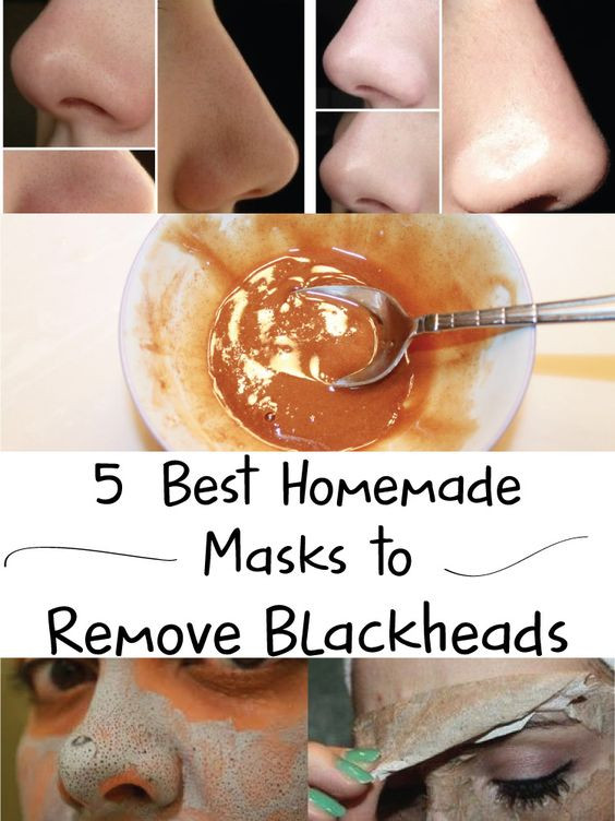 Anti Blackhead Maske Diy
 Homemade mask Masks and Reme s on Pinterest