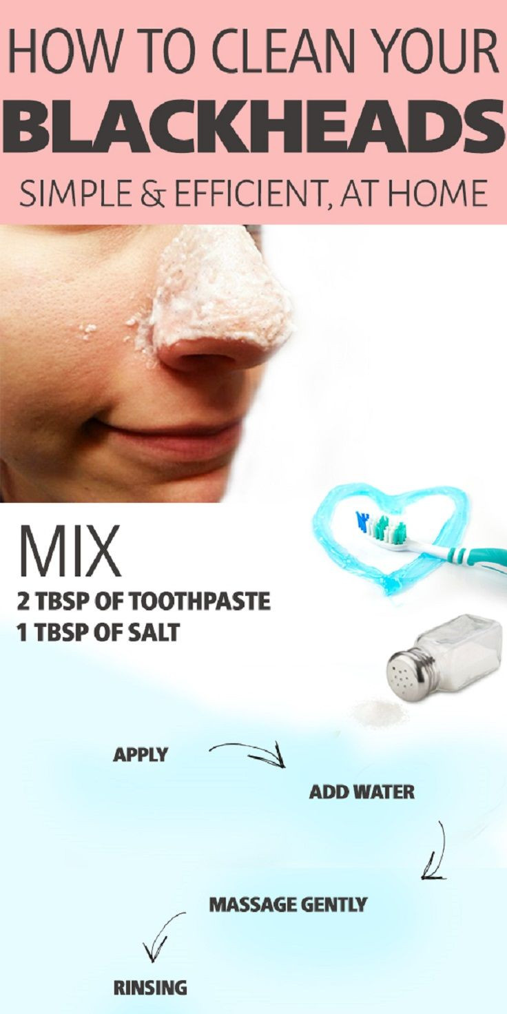 Blackhead Mask Diy
 Best 25 Blackhead mask ideas on Pinterest