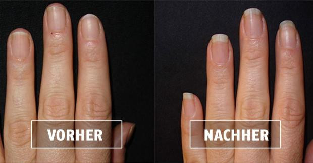 Maniküre Vorher Nachher
 Maniküre Dieses selbstgemachte Nagelbad lässt deine Nägel