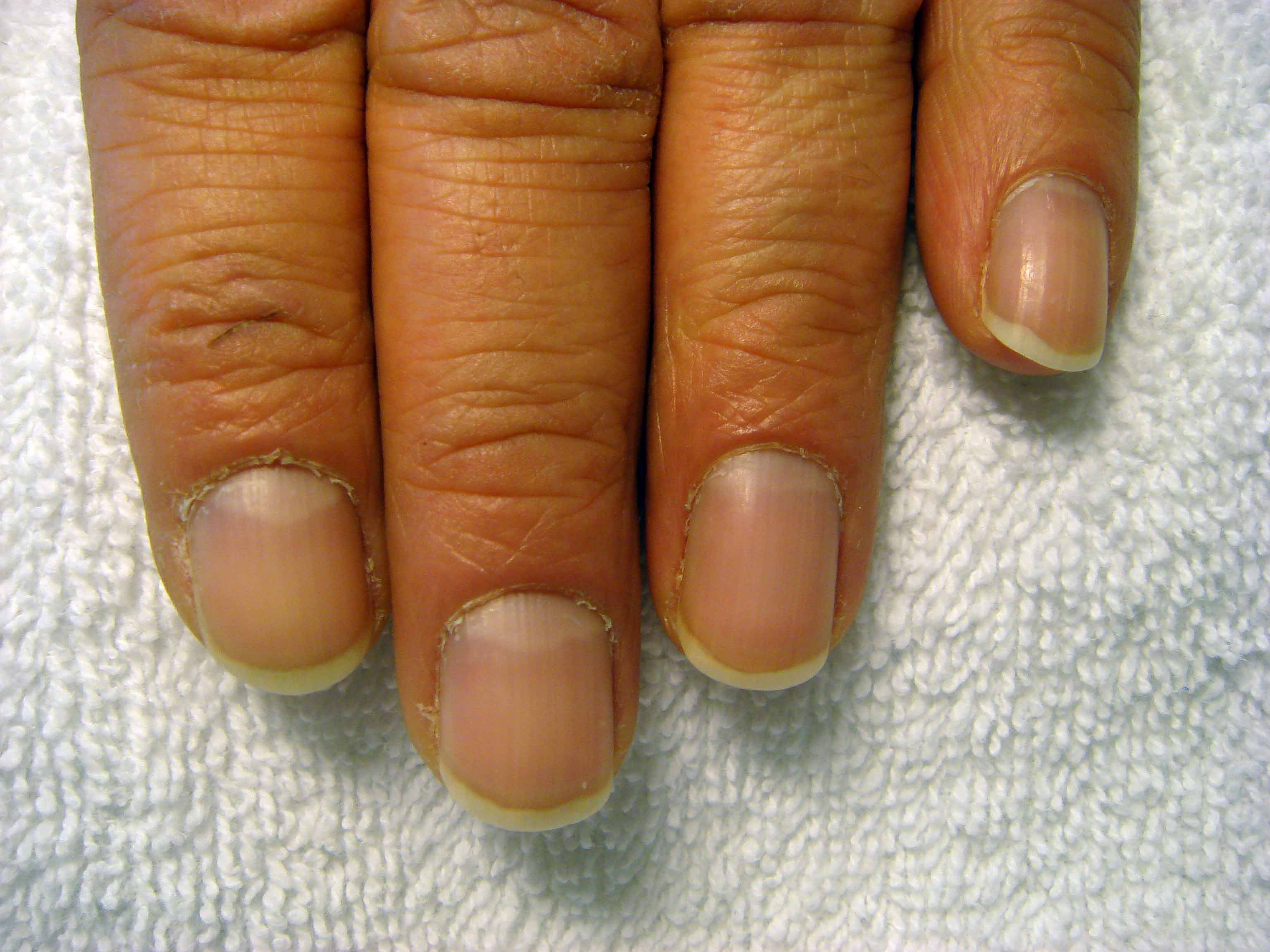 Maniküre Vorher Nachher
 Nageldesign Monique Maniküre Männer