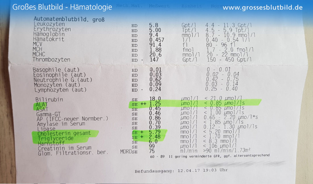 Die Besten Ideen Für Blutwerte Tabelle - Beste Wohnkultur, Bastelideen