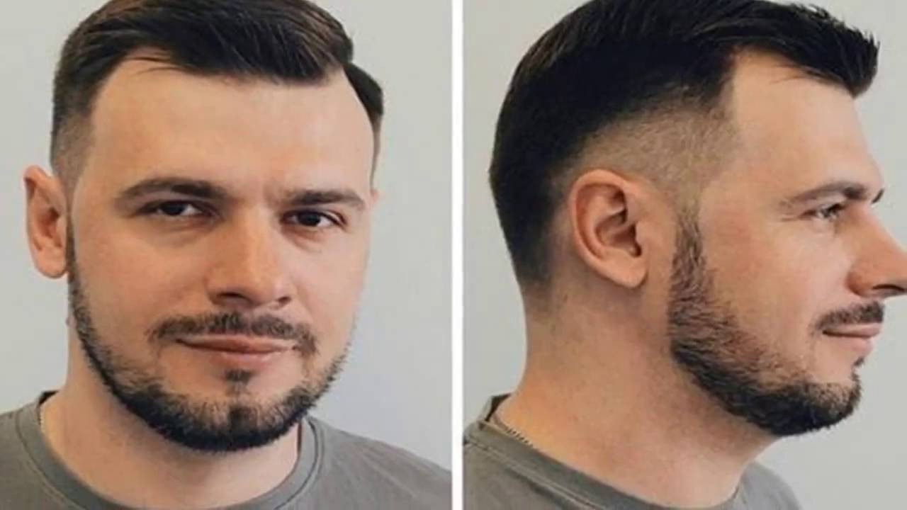 Frisuren Für Beginnende Glatze
 Frisuren für Männer Glatze
