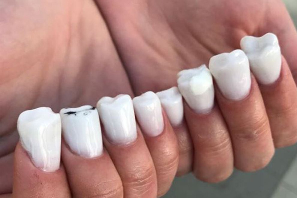 Was Ist Maniküre
 Sind Zahn Nägel der ekeligste Maniküre Trend der Welt