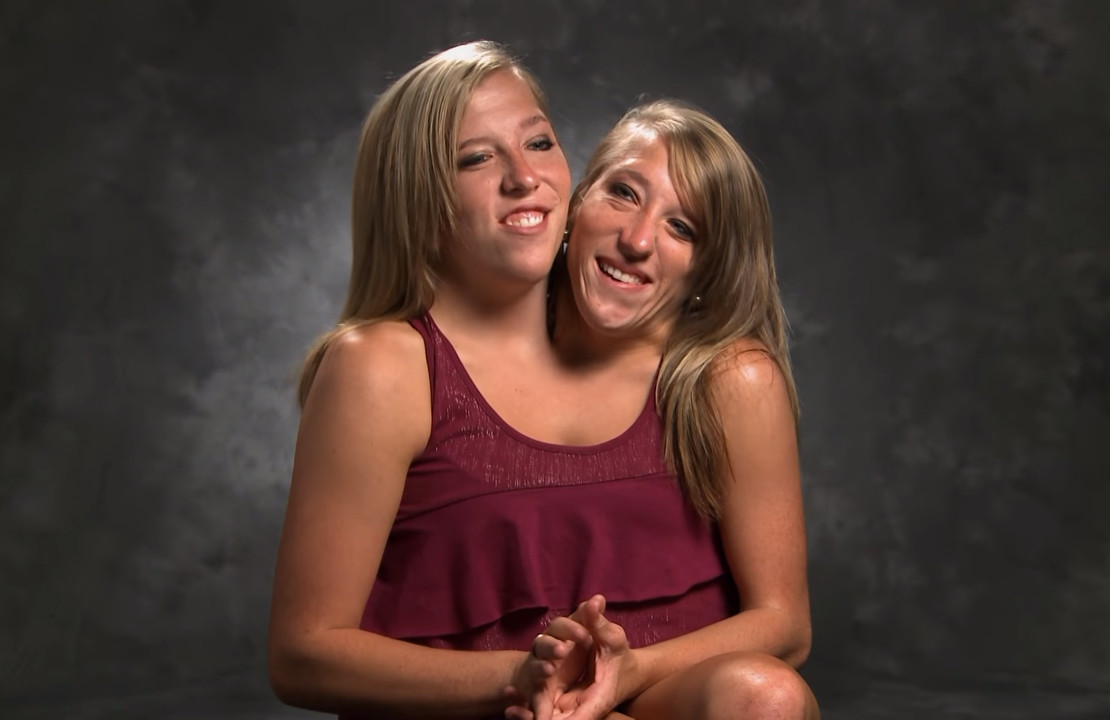 Abby Brittany Hensel Hochzeit
 27 Years After These Conjoined Twins Were Born They Have