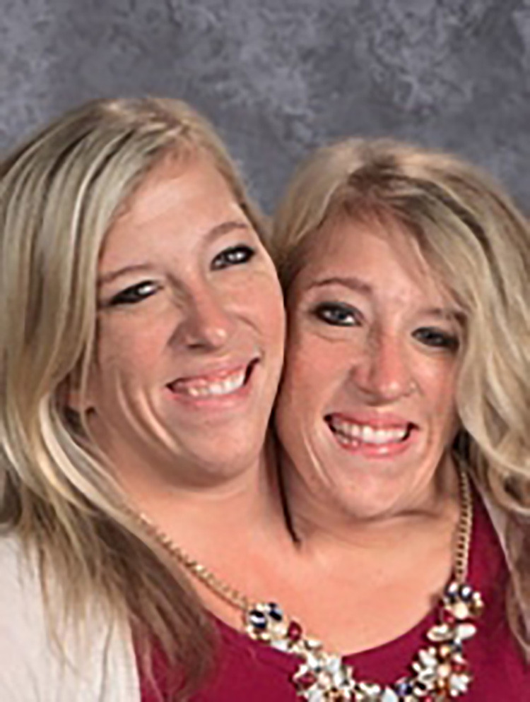 Abby Brittany Hensel Hochzeit
 Abby and Brittany Hensel — See What the Famous Conjoined