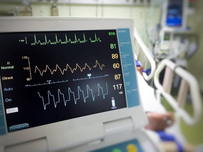 Entzündungswerte Im Blut Tabelle
 Stummer Herzinfarkt Ursachen und Symptome Unbemerkter